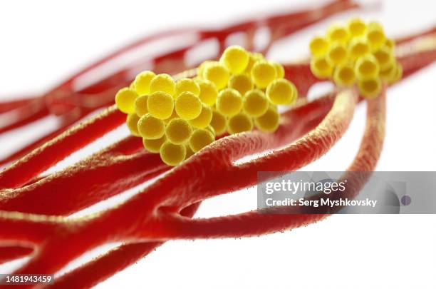 close-up of staphylococcus aureus bacteria inside the human body on a white background. - fournier gangrene fotografías e imágenes de stock