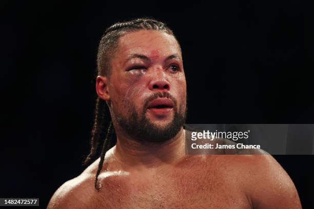 Joe Joyce looks on with a bruised eye during the WBO Interim World Heavyweight Title fight between Joe Joyce and Zhilei Zhang at Copper Box Arena on...