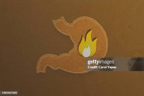 burning stomach. gerd - gastroenteritis stock pictures, royalty-free photos & images