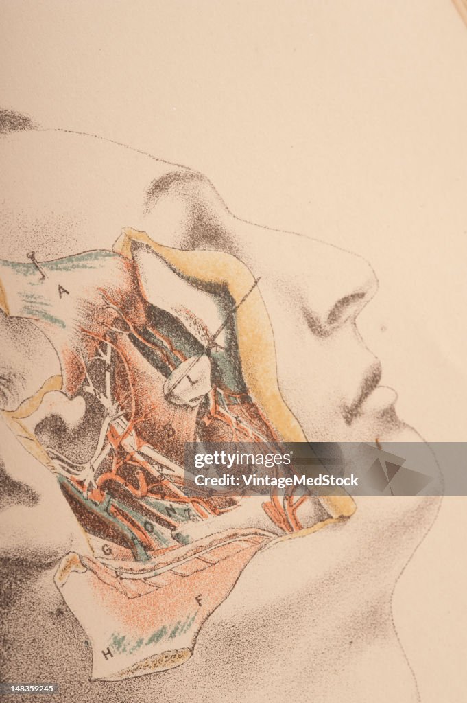 Deep Dissection Of The Pterygoid Region