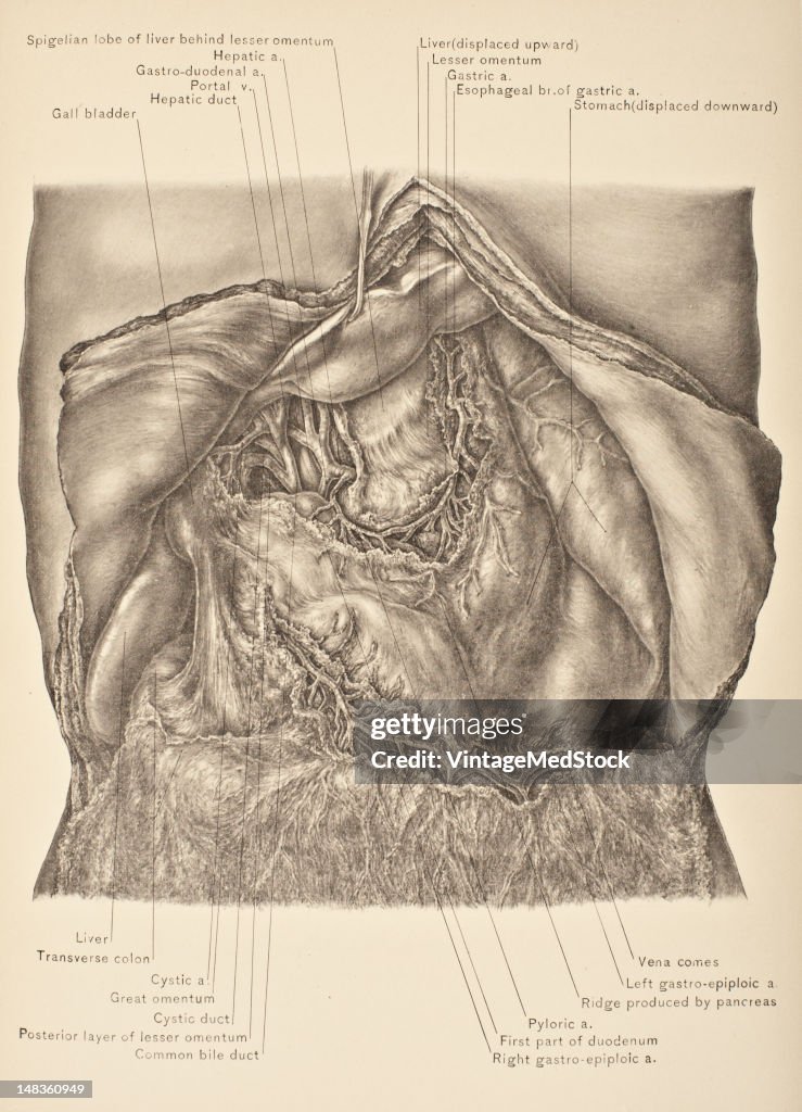 Structures In Great Omentum & Lesser Omentum