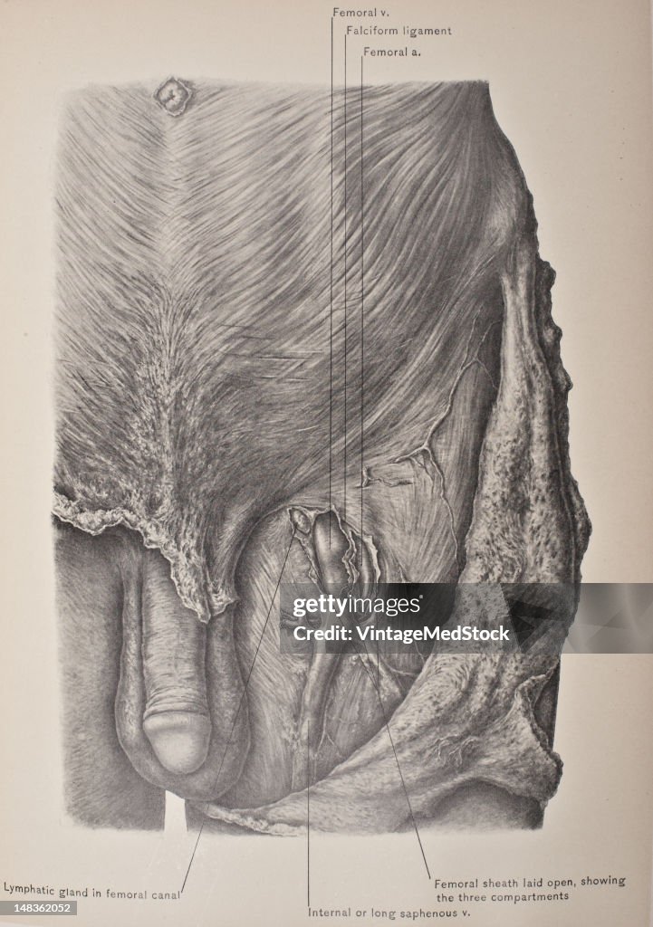 Saphenous Opening, Femoral Canal, & Compartments Of Femoral Sheath