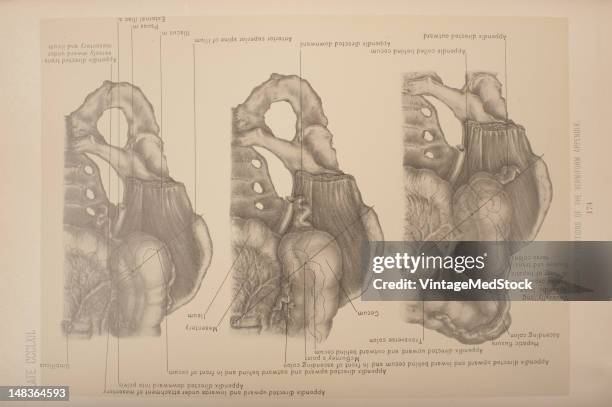 Apendix Drawing 51 Appendix Diagram Stock Photos, High-Res Pictures, and Images - Getty ...
