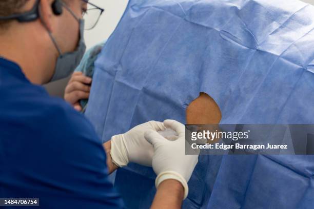 anesthesiologist doctor applying epidural anesthesia with a syringe on his patient's back - verdovingsmiddel stockfoto's en -beelden