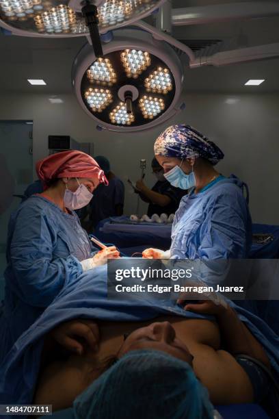 two female surgeons perform a caesarean section in the operating room - central mexico ストックフォトと画像