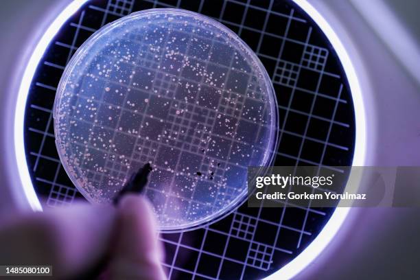 hand holds petri dish with bacteria culture - kolonie stockfoto's en -beelden