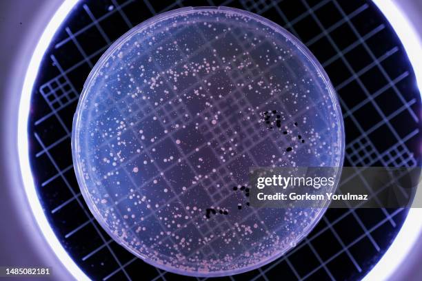 hand holds petri dish with bacteria culture - agar jelly stock pictures, royalty-free photos & images