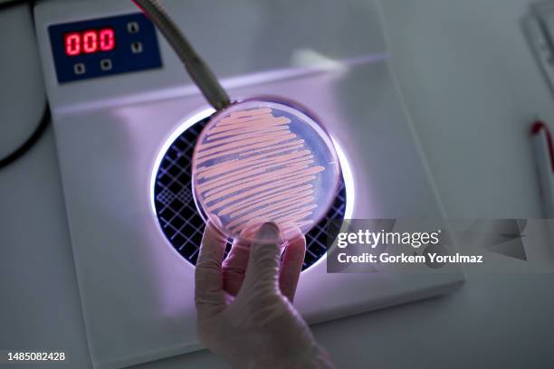 hand holds petri dish with bacteria culture - microbiology stock pictures, royalty-free photos & images