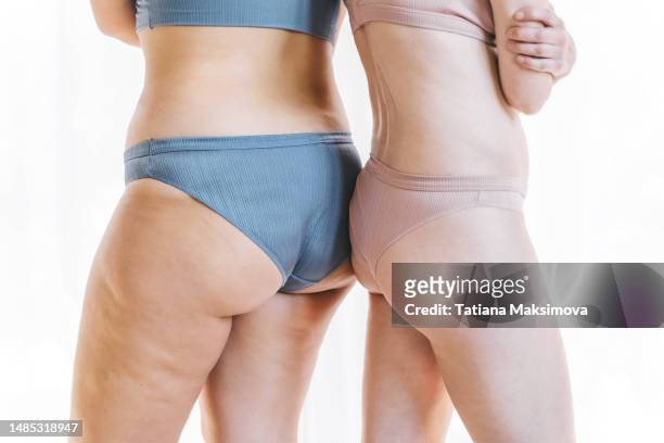 two different unrecognizable women in underwear close-up. the concept of body positive and femininity. - cellulit bildbanksfoton och bilder