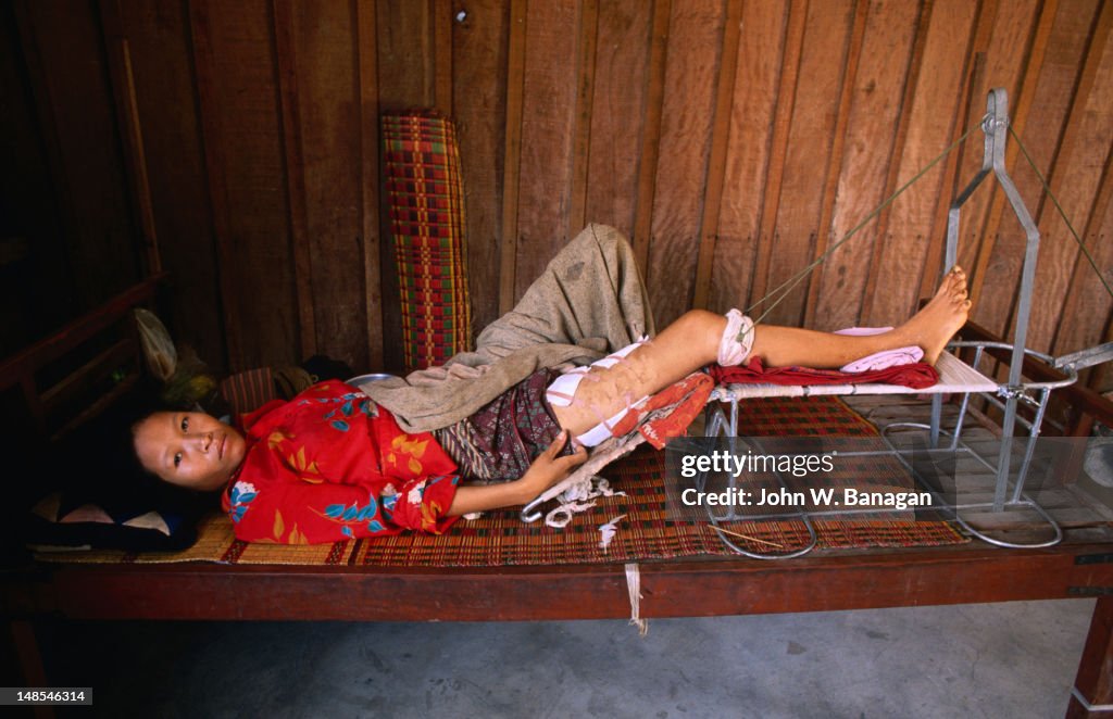 Land-mine victim in Kompong Speu.