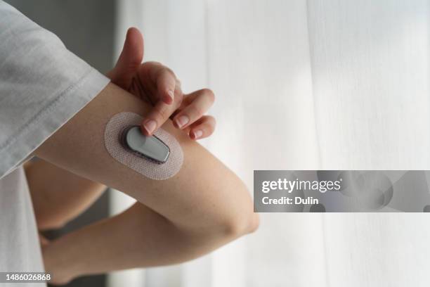 close-up of a woman attaching a continuous glucose monitor to her arm - blood sugar test stock pictures, royalty-free photos & images