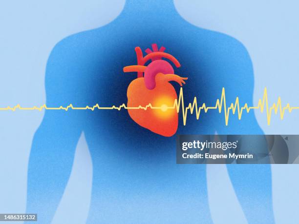 heart with pacemaker - ecg atrial fibrillation stock pictures, royalty-free photos & images