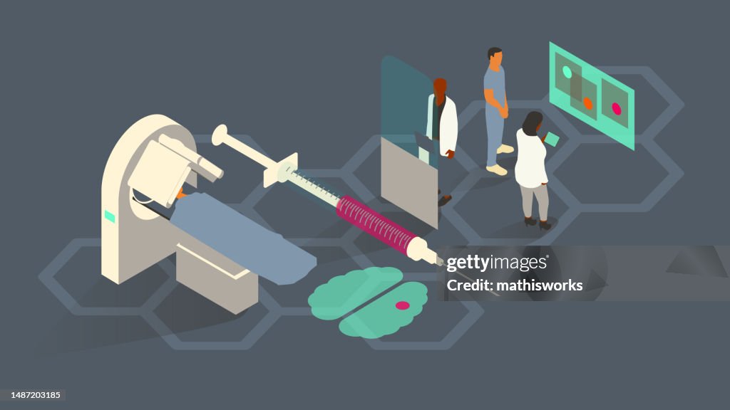 SPECT Illustration