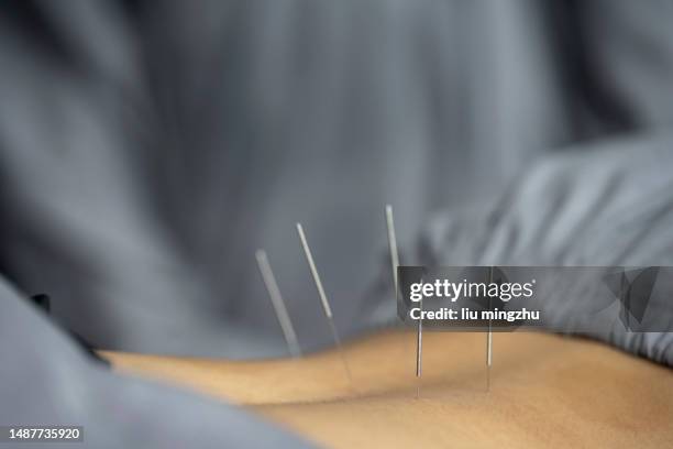 traditional chinese medical acupuncture - chinese herbal medicine stock pictures, royalty-free photos & images