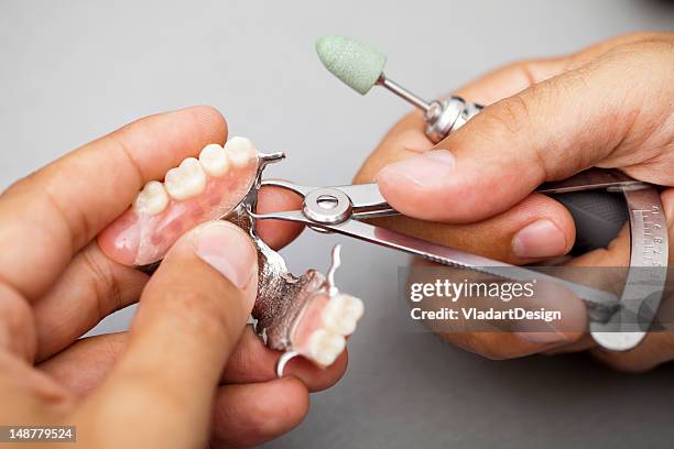 técnico dental medición de las prótesis dentales - equipo protésico fotografías e imágenes de stock