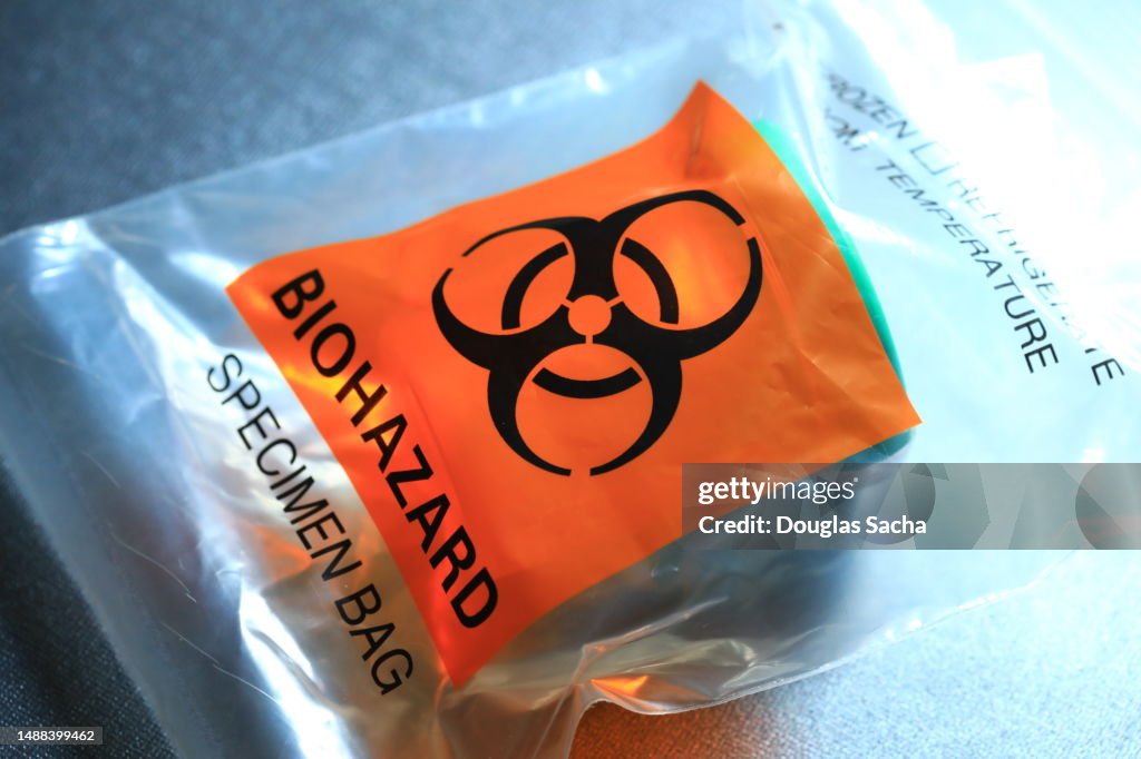 Specimen biohazard bag with bodily fluid sample for research