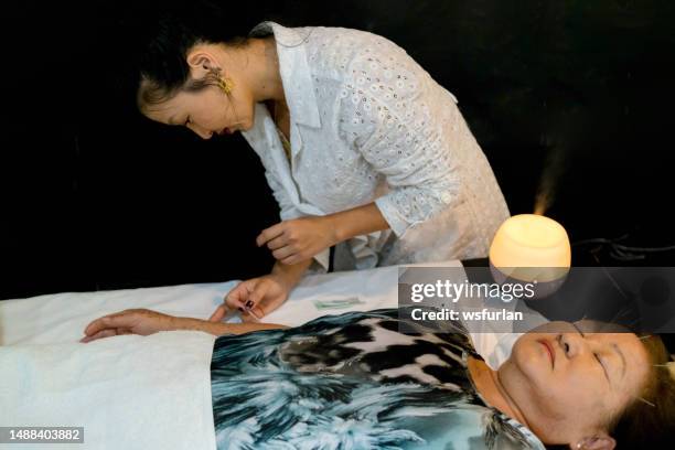 aupuncturist - acupuncture stock pictures, royalty-free photos & images