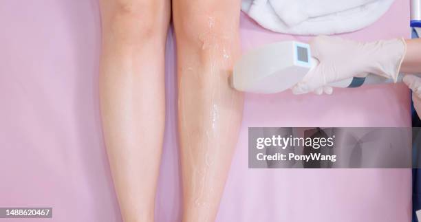 woman leg laser hair removal - hair removal stockfoto's en -beelden