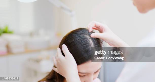el médico examina el cuero cabelludo con las manos - pérdida de pelo fotografías e imágenes de stock