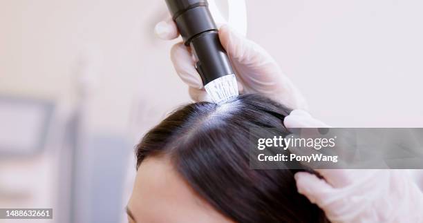 examen médico cuero cabelludo con microscopio - cuero cabelludo fotografías e imágenes de stock