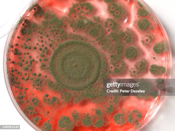 bacteria in a petri dish - antibiotikaresistent stock-fotos und bilder