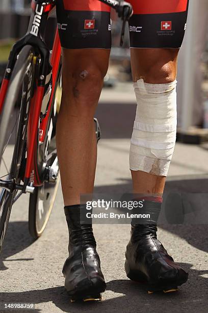 The bandaged legs of Stephen Cummings of Great Britain and BMC Racing Team are seen prior to starting stage nineteen of the 2012 Tour de France, a...