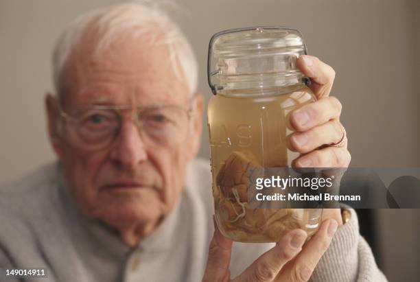 Pathologist Thomas Harvey holds the brain of theoretical physicist Albert Einstein in a jar, Kansas, 1994. Harvey performed the autopsy on Einstein...