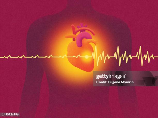 female silhouett and heart with pacemaker - atrial fibrillation stock pictures, royalty-free photos & images