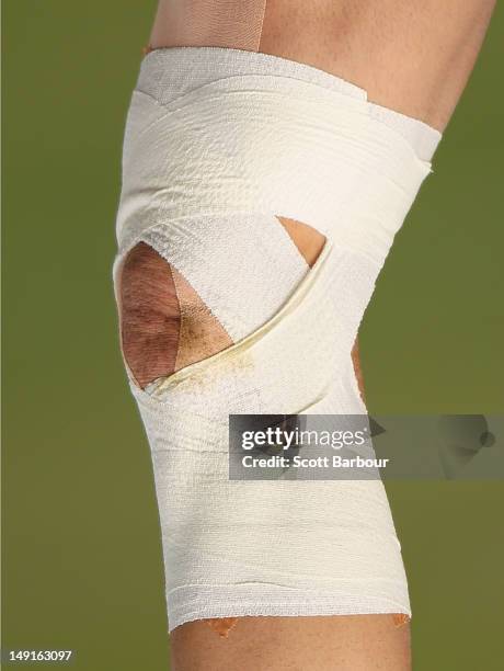 Detail of the injured knee of Billy Slater of the Storm during a Melbourne Storm NRL training session at Gosch's Paddock on July 24, 2012 in...