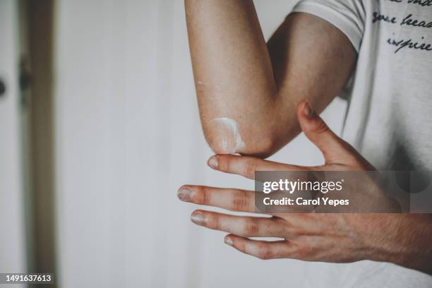 dry skin elbow - grädde bildbanksfoton och bilder