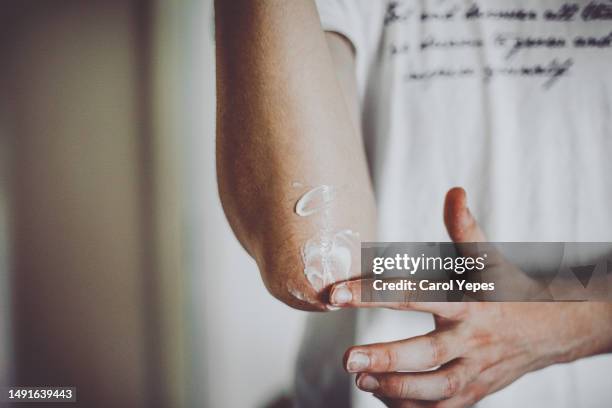 dry skin elbow - eczema stock pictures, royalty-free photos & images