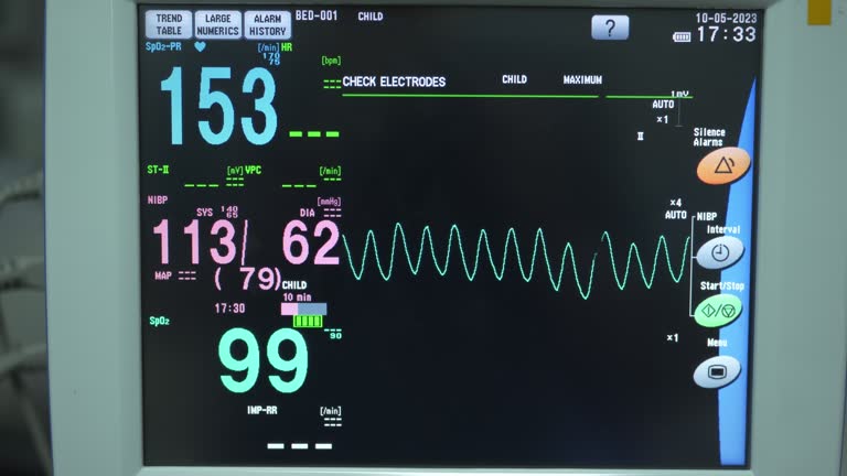 Pacemaker Machine Monitor Pacemaker Monitor Videos and HD Footage - Getty Images