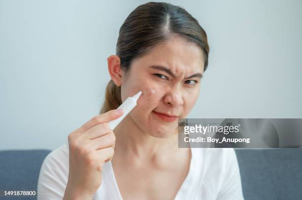 portrait of worried asian woman while squeezing acne cream from cosmetic tube on her skin for treat acne problem. - cream tube stock pictures, royalty-free photos & images