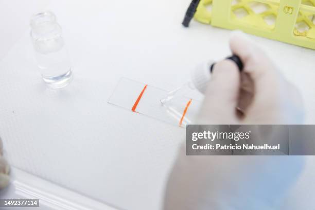 laboratory expertise: young female medical technologist holding gram stained sample on a microscope slide.. - gram stain stockfoto's en -beelden