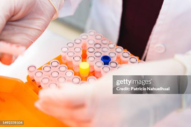 Microtubes Lab 53 Microtubes Stock Photos, High-Res Pictures, and Images - Getty Images