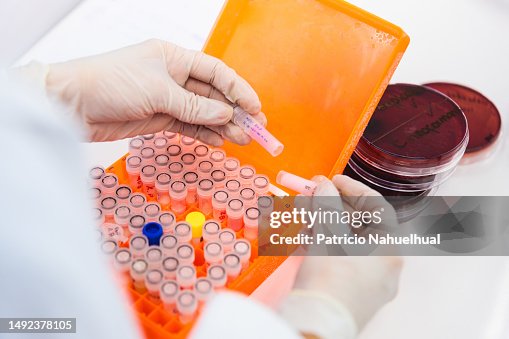 Unrecognizable laboratory technician using a microtubes box Unrecognizable laboratory technician using a microtubes box