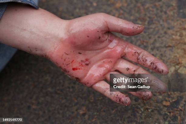 An activist of the Last Generation climate action group shows her hand after police used a solvent to unglue it from the asphalt after she and others...