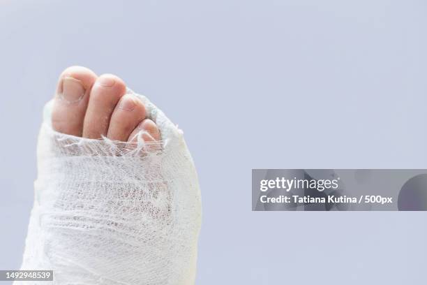 low section of person with bandage against white background,russia - cast of creed stock pictures, royalty-free photos & images