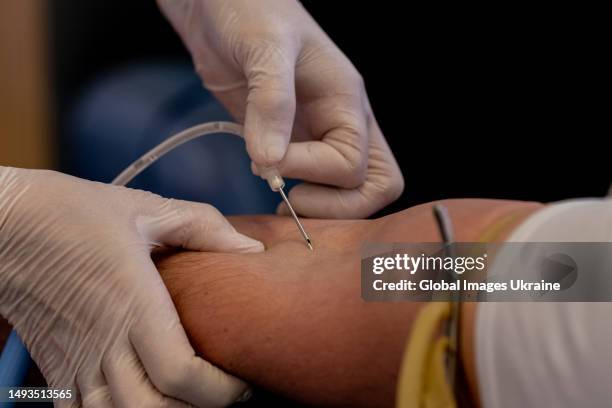 Nurse inserts a needle into man’s arm in mobile blood station on May 25, 2023 in Lviv, Ukraine. FESTrepublic space with Lviv Regional Blood Service...