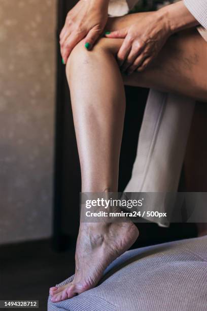 aging of the legs skin the appearance of veins and cellulite venous - distorted body image stock pictures, royalty-free photos & images