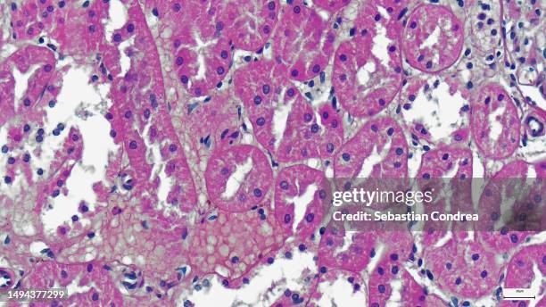 microscopic photo of a professionally prepared slide demonstrating breast tissue - microfotografia immunofluorescente foto e immagini stock