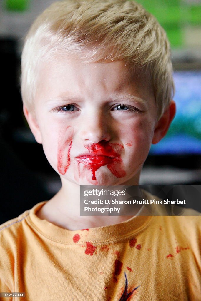 Toddler boy with Nosebleed Portrait