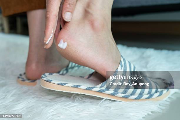 close up of person applying moisturizer on foot for treat cracked heel problem. cracked heels occur when dry, thick skin on the bottom of your heels cracks and splits. - cremefarbige schuhe stock-fotos und bilder