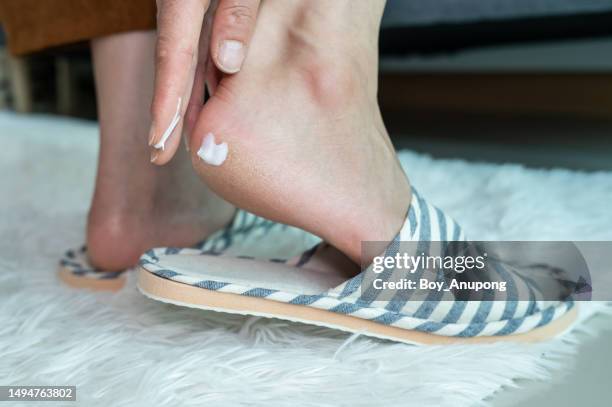 close up of person applying moisturizer on foot for treat cracked heel problem. cracked heels occur when dry, thick skin on the bottom of your heels cracks and splits. - pies fotografías e imágenes de stock