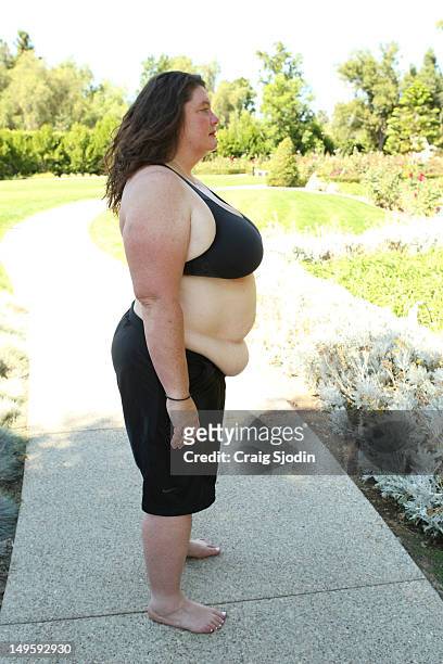 Sally" - A 45-year-old devoted mother and wife, Sally never dealt with obesity till her 30s. A marketing and communications pro who now works as a...