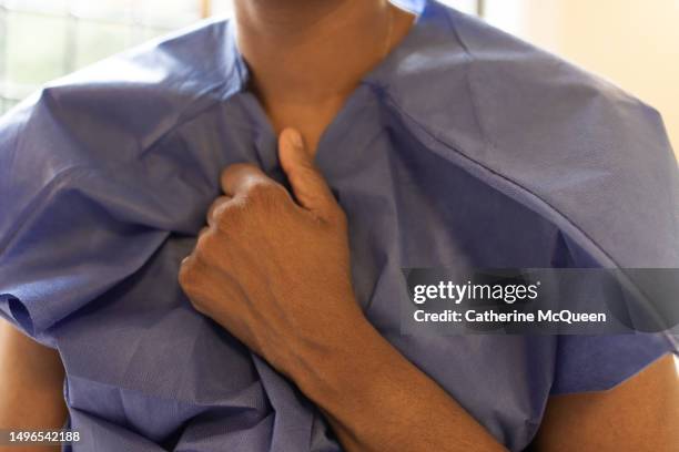 anxious black woman clutches hospital medical gown - hospital gown imagens e fotografias de stock