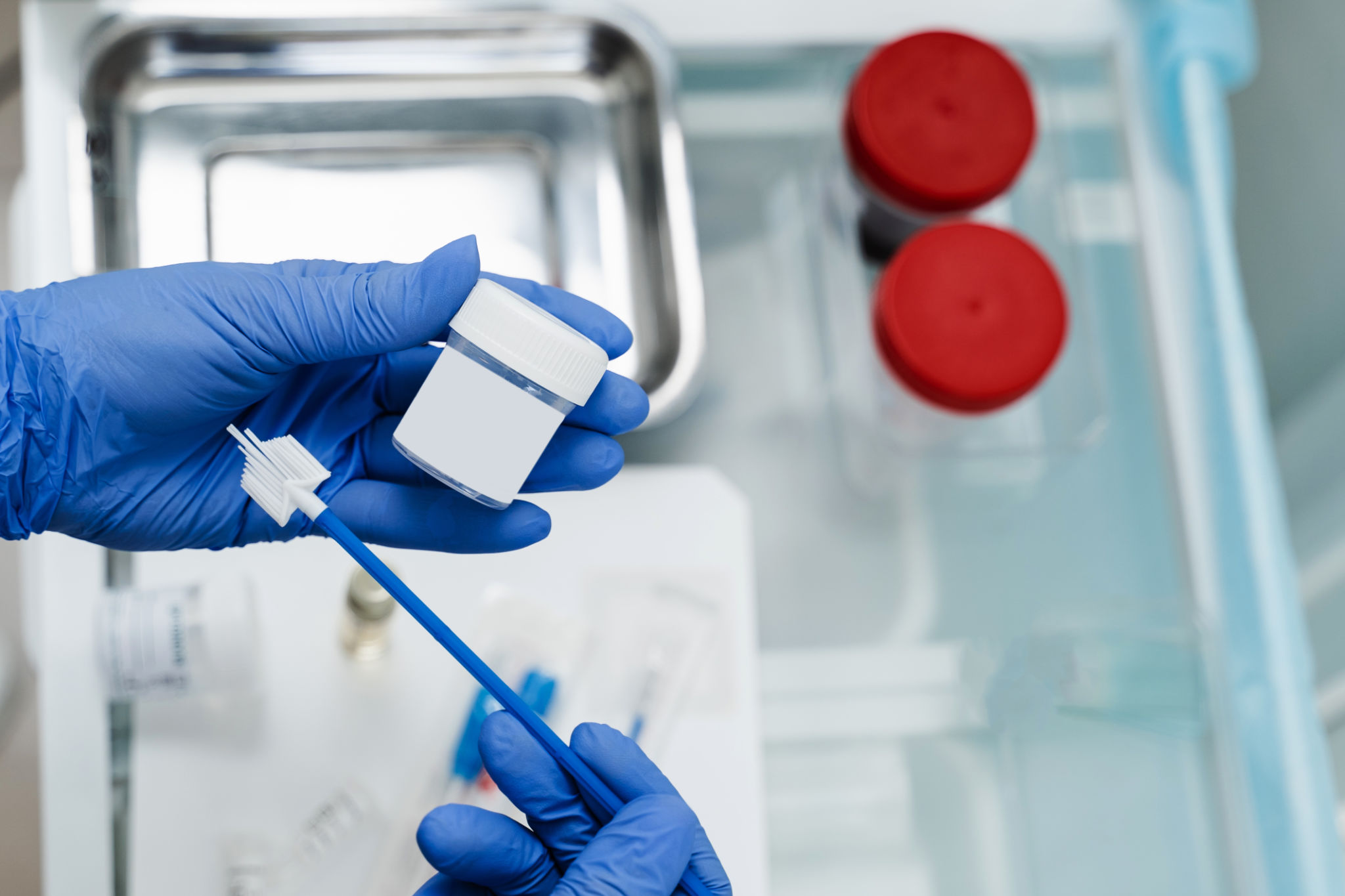 pap smear