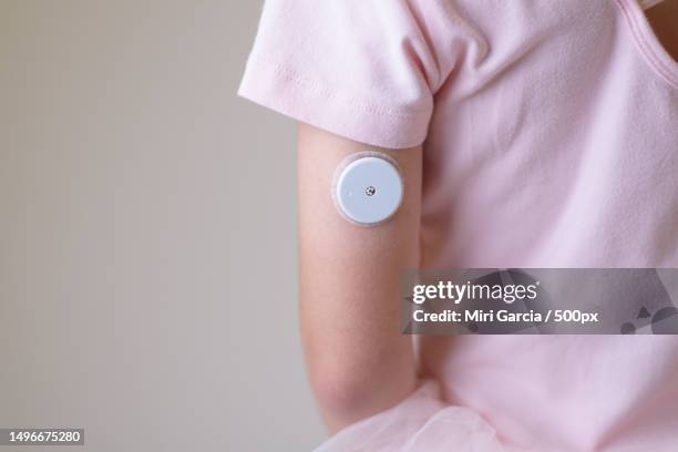 blood glucose sensor on the arm of a child sensor for remote measurement of blood glucose levels - glucose stock pictures, royalty-free photos & images
