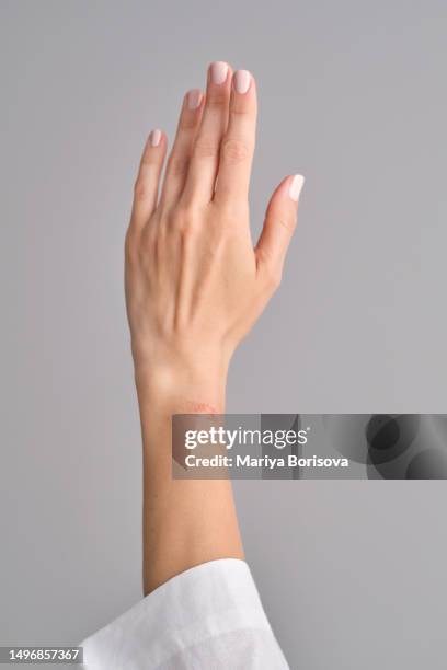 burn on a woman's hand. - sun blistered stock pictures, royalty-free photos & images