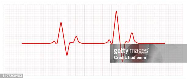 ilustraciones, imágenes clip art, dibujos animados e iconos de stock de patrón de vector electrocardiograma y corazón (concepto de salud) - taking pulse
